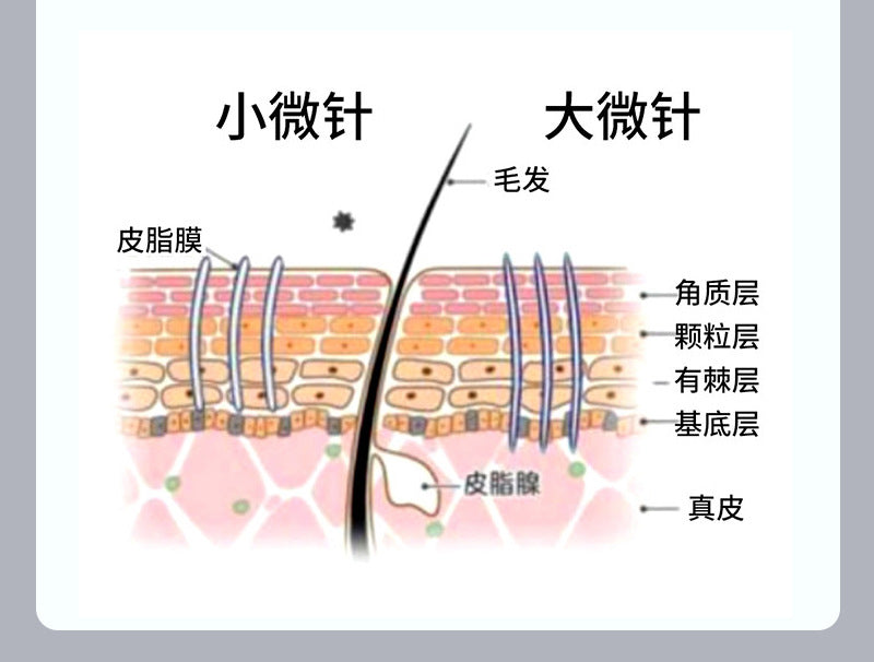 6a0877bd-ac2e-40fe-a81c-8139e8ea09e3